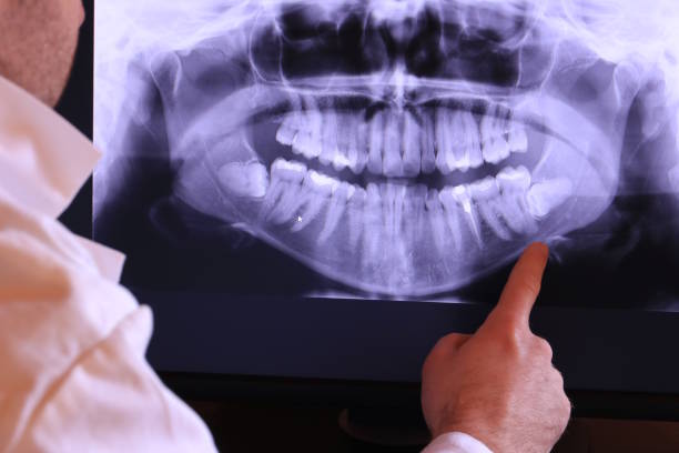 Best Emergency Root Canal Treatment in Ahtanum, WA